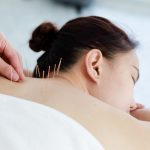 Treating Pain with Acupuncture